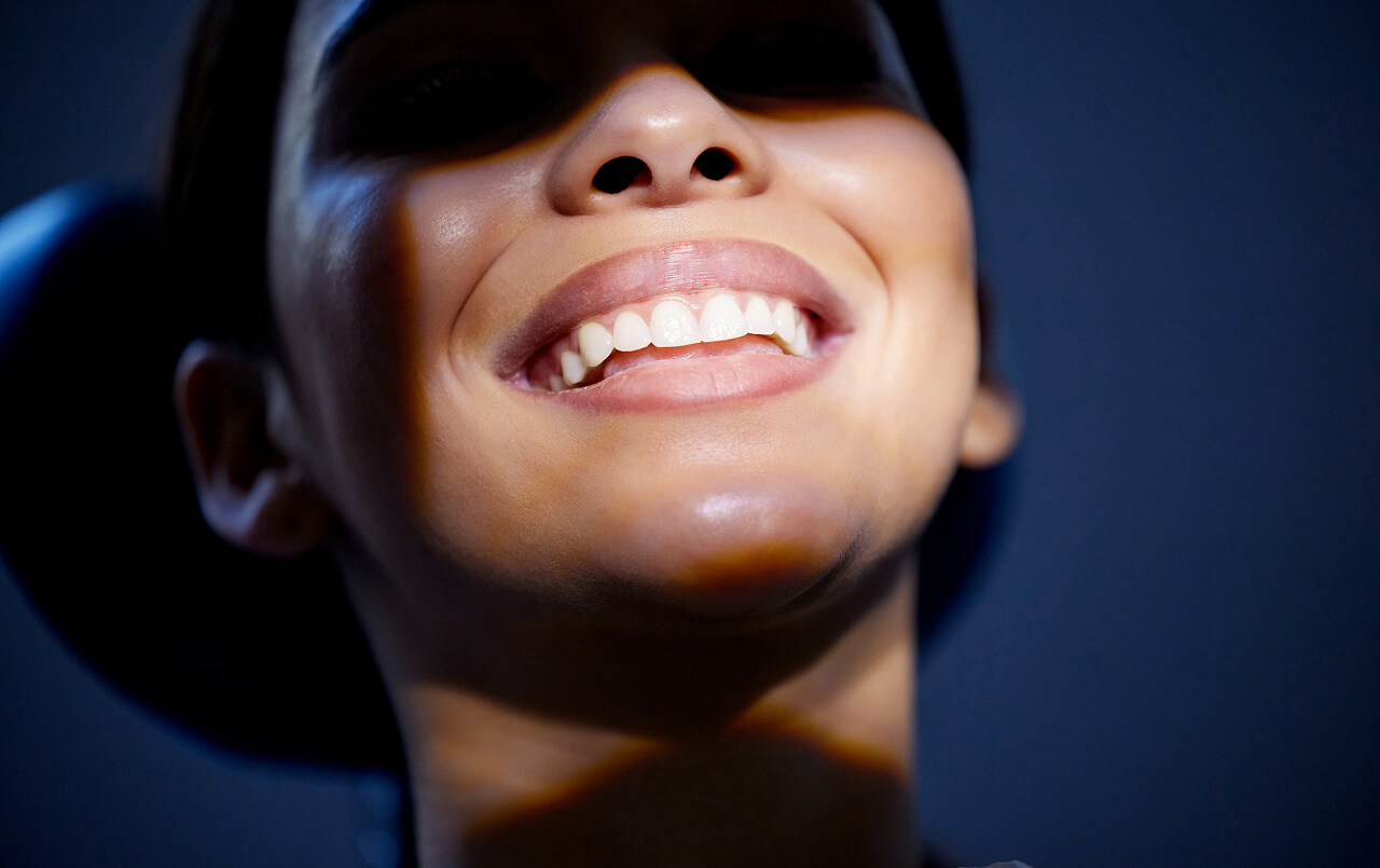 The Benefits of Cosmetic Bonding for Chipped or Uneven Teeth