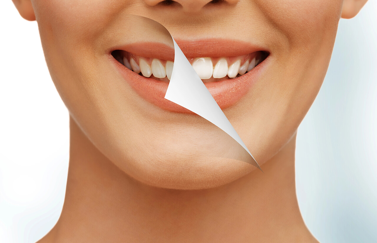 Top 5 Signs You Need a Dental Cleaning—Even If Nothing Hurts